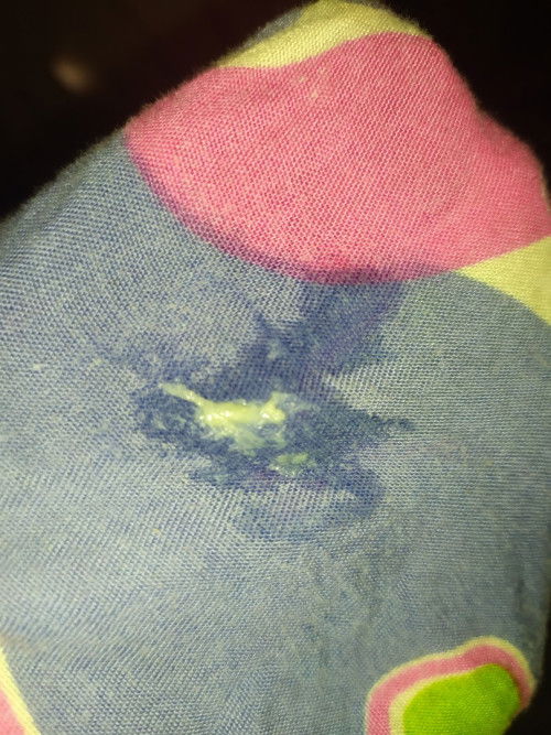 Bun mau tanya apakah ini tanda" Mau melahirkan, seperti ingus ...