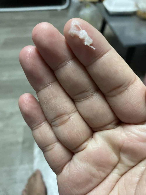 36+4 มูกหรือตกขาวคะ