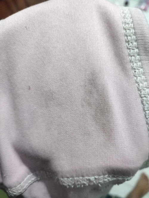 Flek kehamilan 7 week