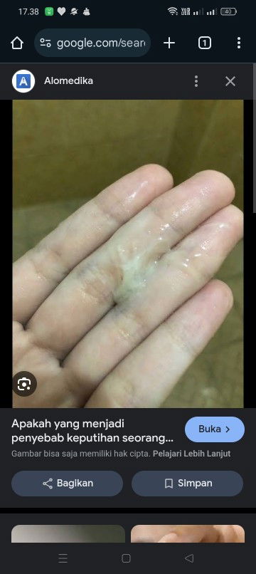 Keputihan sebelum hamil dan sekarang hamil