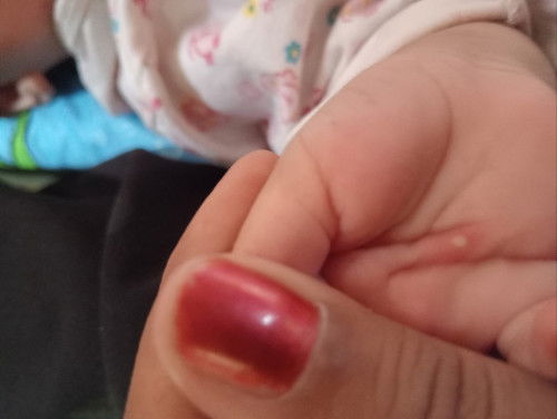 สอบถามแม่ๆ