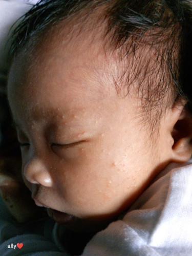 Hello mga mhie, normal lang Po ba eto sa newborn. 22days plang ni baby.