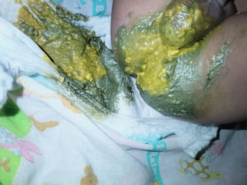 Bun bayi ku 2 bulan 19 hari tadi malam bab nya kok warna hijau keabu abuan .
