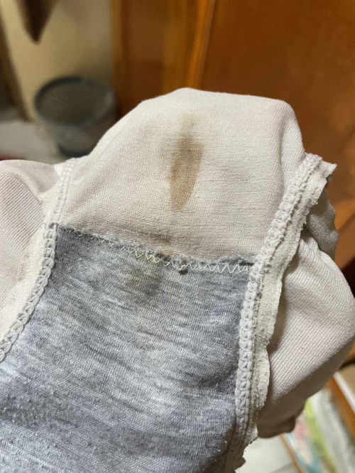 Keluar bercak/ flek darah