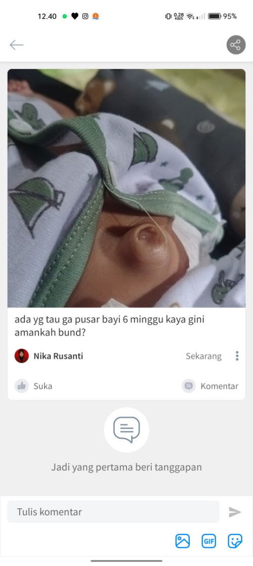 Pusar bayi 6 minggu , normal kah bund ?