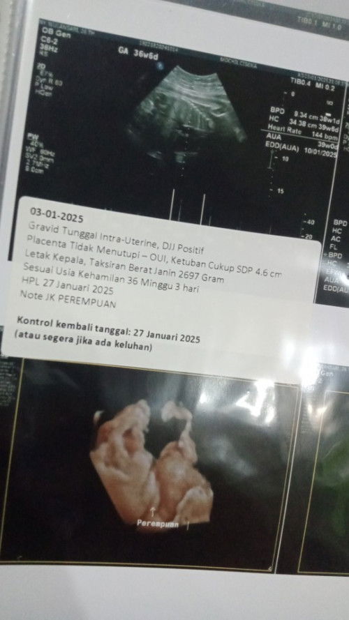 Masuk 36minggu 3hari