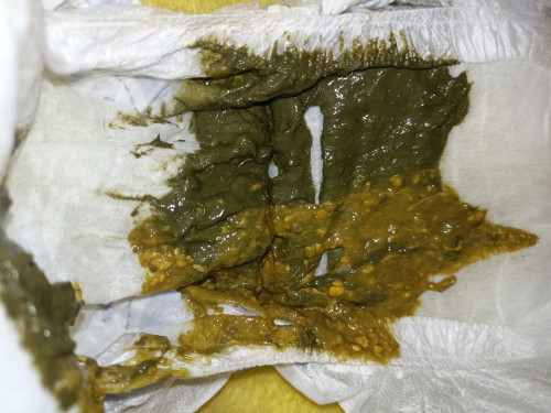 Color poop