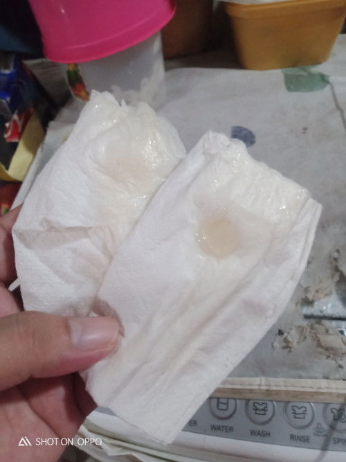 Mucus plug na ba ito sign na ba to na malapit na ako mag labor?