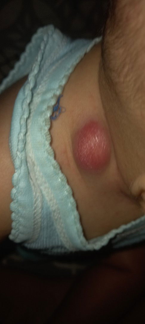 Ada yg ngalamin gini nga bun?