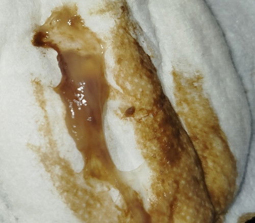 Good evening po sa lahat ng mommy! May I ask lang po ako.