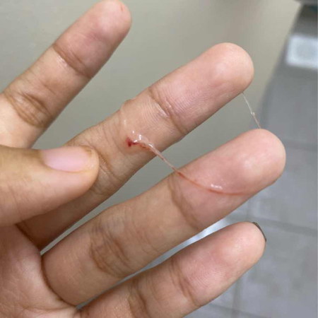 keputihan lendir + darah