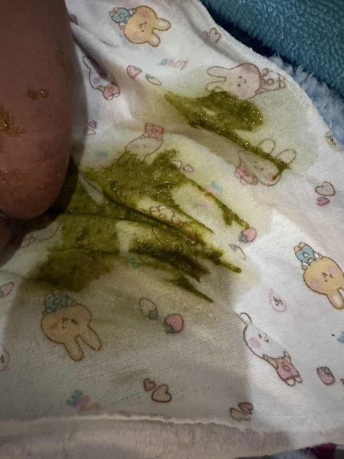 ทารก 1 เดือนท้องเสียเสี่ยงติดเชื้อไหมคะ?