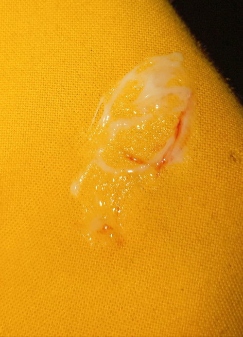 Tanong KO Lang po mucus plug po BA ito o normal discharge?38 weeks na ako Ngayon.