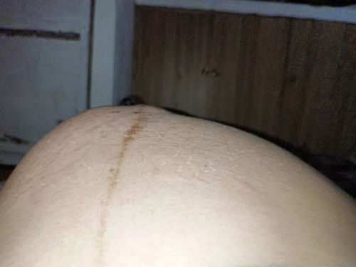 37WEEKS close cervix pa din.