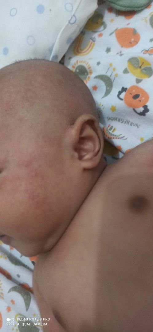 Ruam, dikasih apa ya bun?