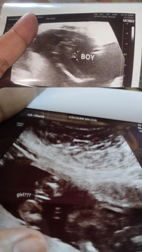 Confuse girl ke boy nimπ₯²