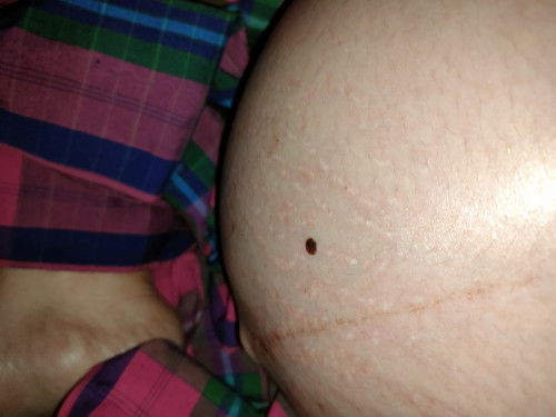 Rekomendasi dan saran