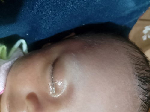 Bund ada yang tau obat untuk mata soal nya anakku baru usia 20 hari TPI matanya kaya belakan