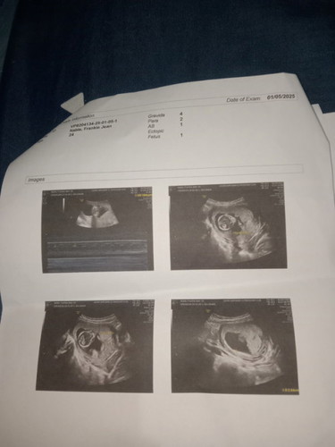 14weeks ultrasound