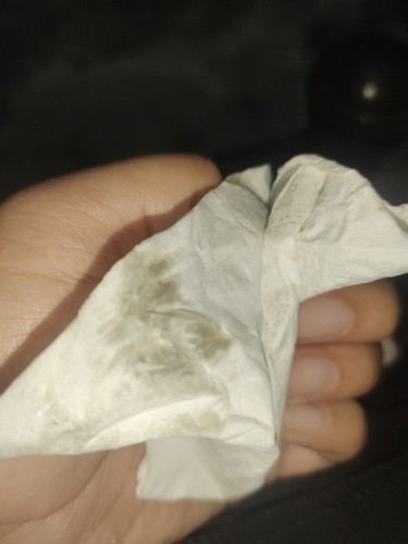 Spotting atau keputihan