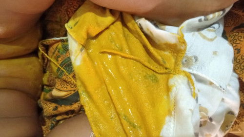 Diare bayi usia 3 bulan