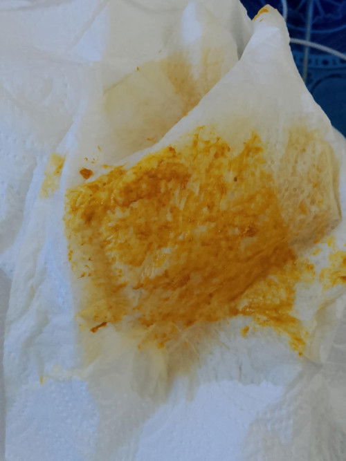 การขับถ่าย