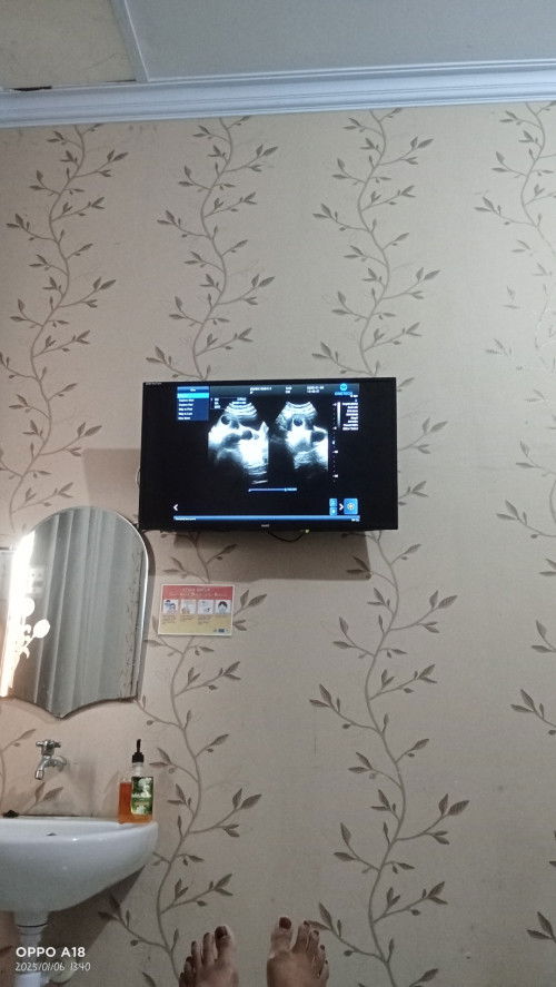 hamil 8week , dengan kista 3cm