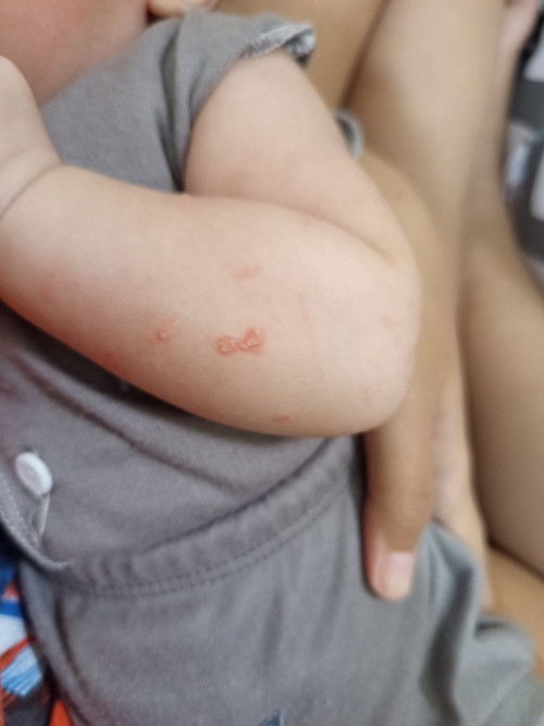 Mau tanya ini kira kira Kenapa ya bayi ku umur 2 bulan