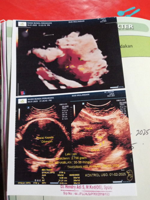 Assalamu'alaikum bun