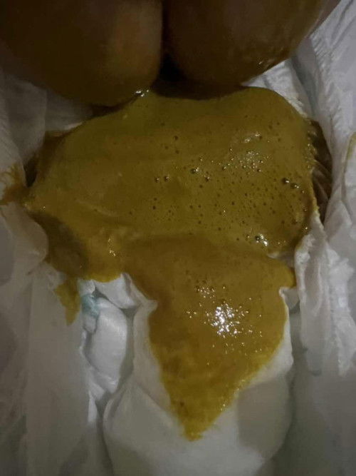 PUP BAYI SEHARI SEKALI DAN BERBUSA