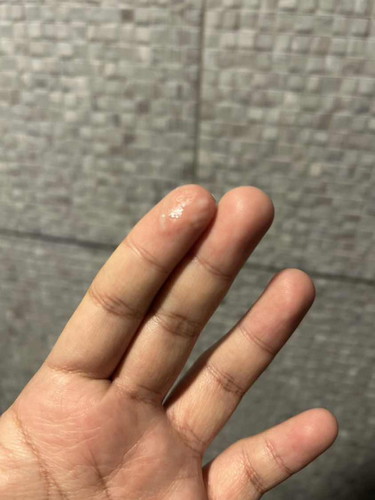 สอบถามแม่ๆค่ะ