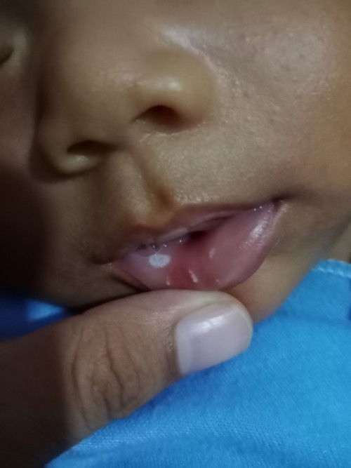 Bunda, ada yg tau ga ini kenapa??  Obatnya apa ya kok kayanya semakin nambahhh 🥺