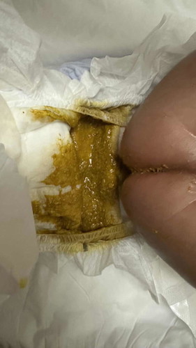 Possible diarrhea