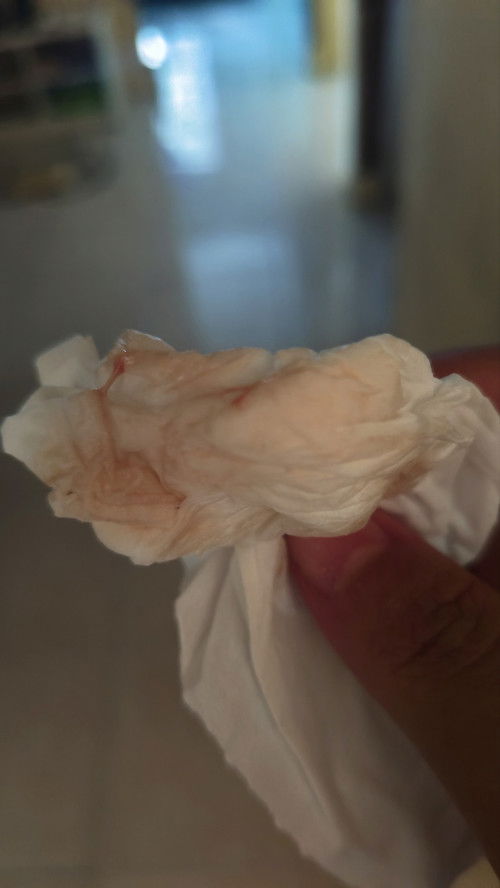 37 week 6 hari keluar lendir campur sedikit darah