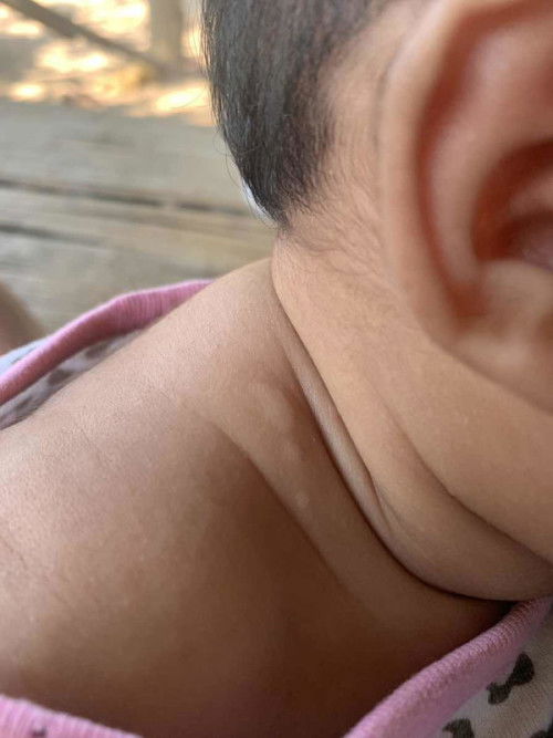 แผลเกี่ยวกับเด็ก