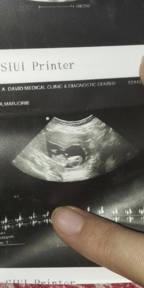 Sa tingin nyo po Boy Or girl