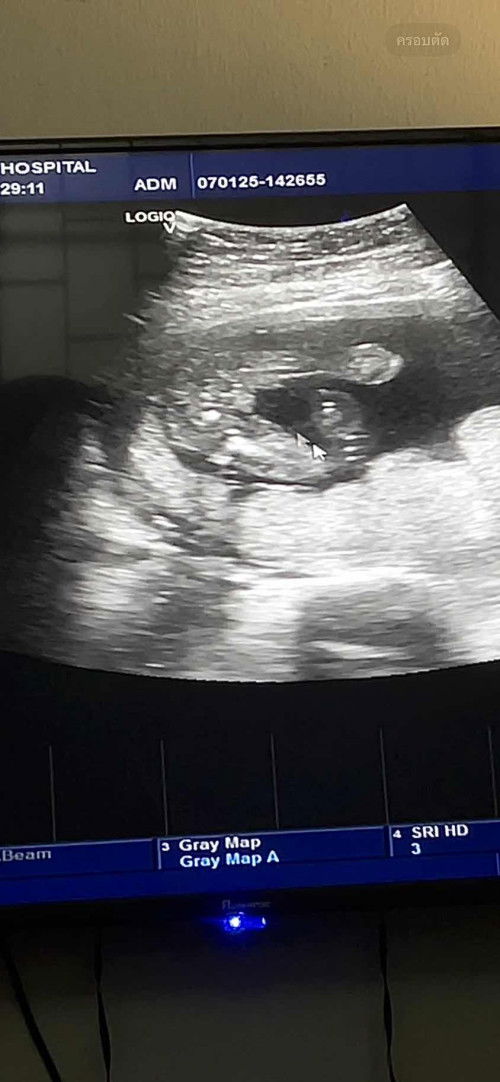 ดูเพศลูกให้หน่อยค่ะ