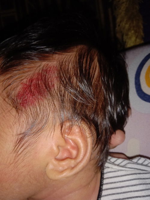 kepala bayi merah