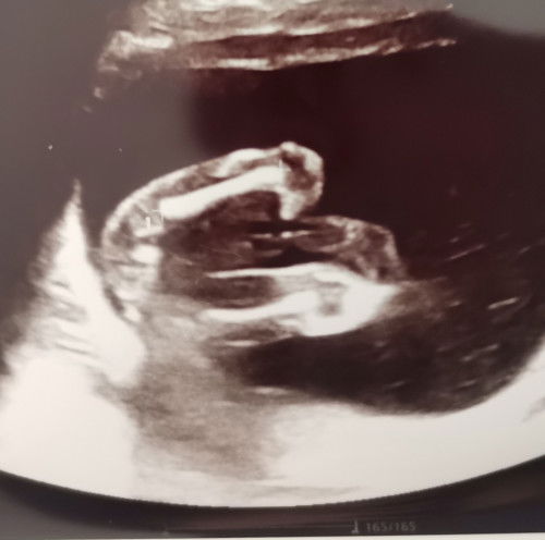 มองว่าเพศอะไรคะ💝👶