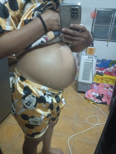31+1 อาการไม่ดีเลยกลัวปากมดลูกเปิด
