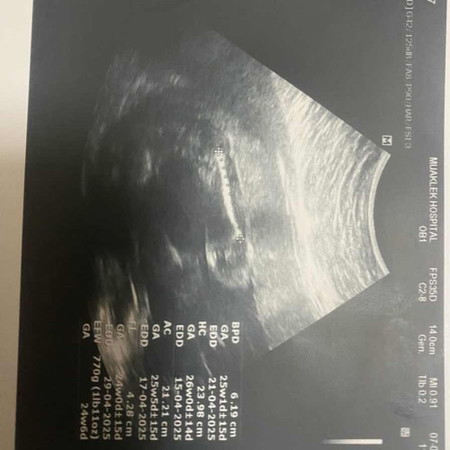 แม่ๆช่วยดูหน่อยค่ะ ลูกชายหรือลูกสาวคะ