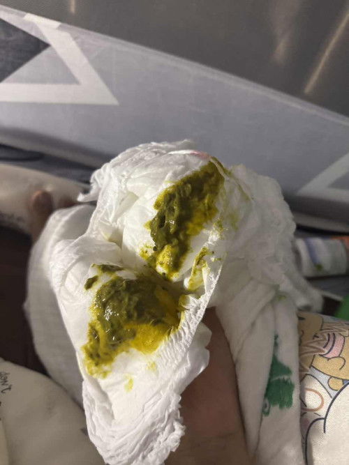 สอบถามเรื่องอึ