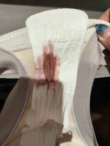 Hi mummies, at week 4 of pregnancy and had some bleeding, haven't seen gynae yet. Is this normal ?