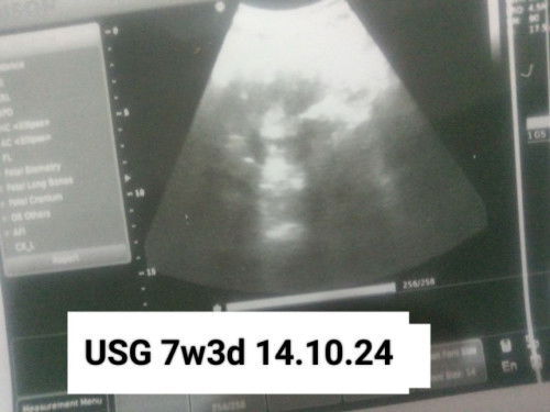 Ada yang pernah alami ini juga gak bun??