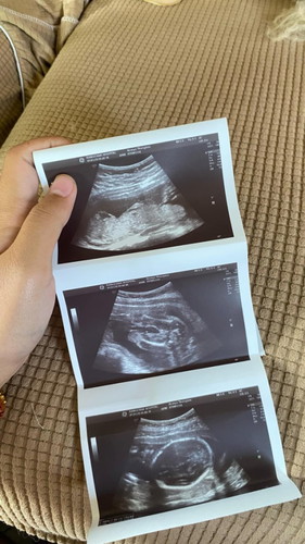 แม่ๆกี่วีคกันแล้วค้าาา🫶🏻