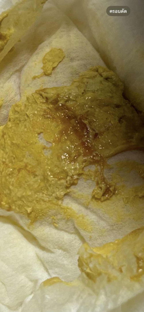 แบบนี้ใช่มูกเลือดไหมคะ