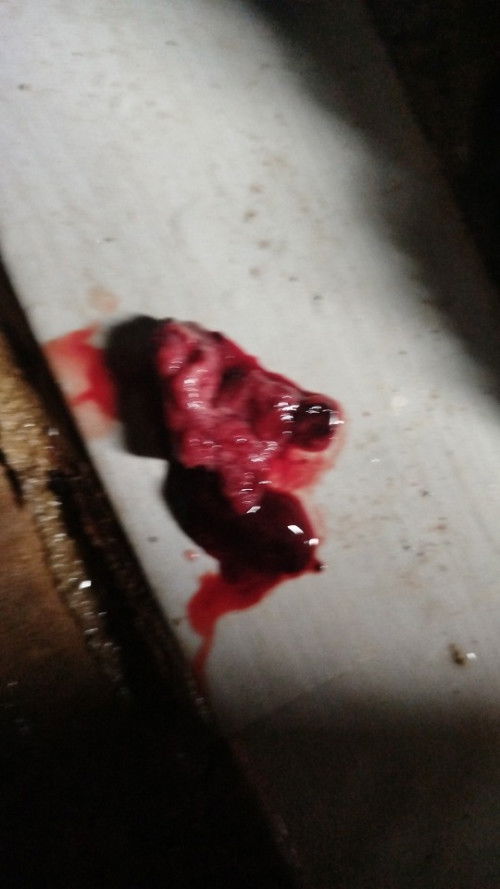 Ini gumpalan apa yah