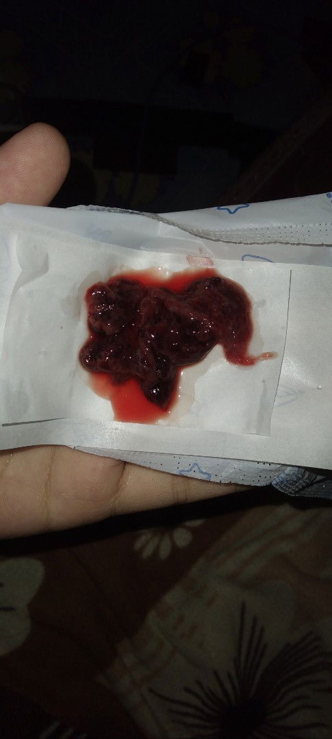 Mau tanya apakah ini bisa dikatakan keguguran atau tidak yah soalnya perut bawah saya sakit banget