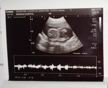 ขออนุญาตถามพี่ๆนะคะพอดีท้องแรก ช่วยดูหน่อยได้ไหมค่ะ อันไหนตัวน้องหรือแขนขาน้อง หนูดูไม่ออก