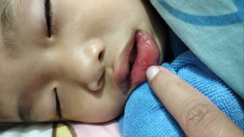 ขอสอบถามแม่ๆทีคะ